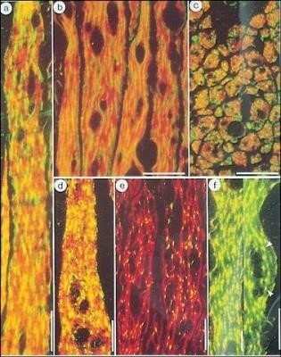 Immunohistochemistry: beta-Actin Antibody (AC-15) - BSA Free [NB110-67828]