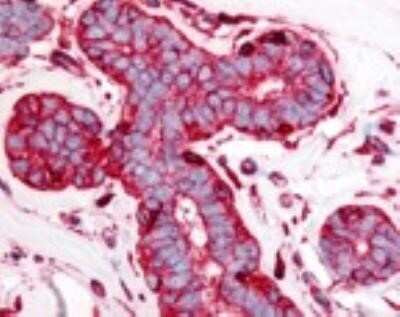 Immunohistochemistry: beta-Actin Antibody (AC-15) - BSA Free [NB110-67828]