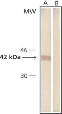 Western Blot: beta-Actin Antibody (AC-15) [NB600-501]