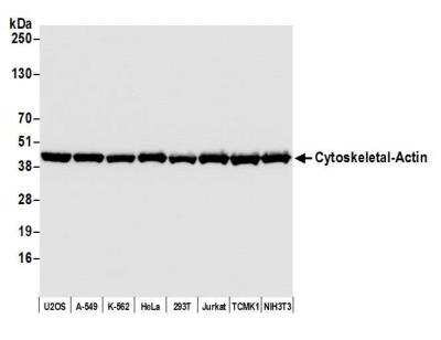 Western Blot: beta-Actin Antibody (BLR057F) [NBP2-76367]