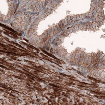 Immunohistochemistry-Paraffin: beta-Actin Antibody (CL3868) [NBP2-76481]