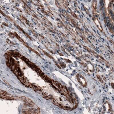 Immunohistochemistry-Paraffin: beta-Actin Antibody (CL3868) [NBP2-76481]