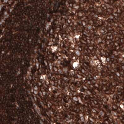 Immunohistochemistry-Paraffin: beta-Actin Antibody (CL3868) [NBP2-76481]