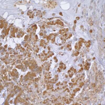 Immunohistochemistry: beta-Actin Antibody [NB600-532]