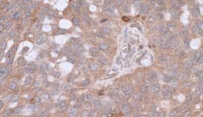 Immunohistochemistry: beta-Actin Antibody [NB600-532]