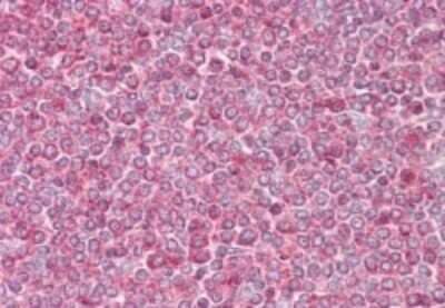 Immunohistochemistry-Paraffin: beta-Actin Antibody [NB100-56874]
