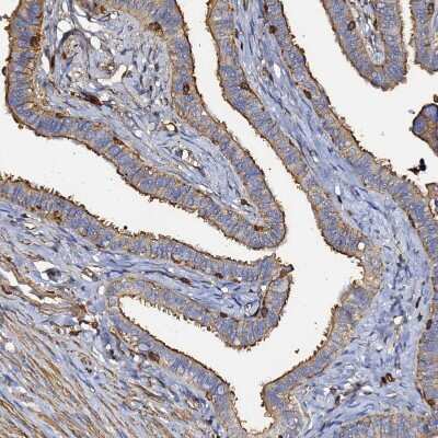 Immunohistochemistry-Paraffin: beta-Actin Antibody [NBP2-54690]