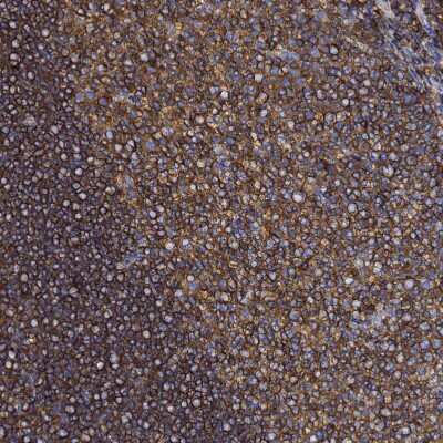 Immunohistochemistry-Paraffin: beta-Actin Antibody [NBP2-54690]