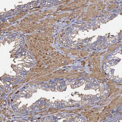 Immunohistochemistry-Paraffin: beta-Actin Antibody [NBP2-54690]