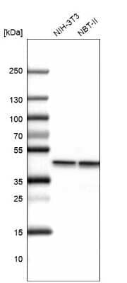 Western Blot: beta-Actin Antibody [NBP2-54690]