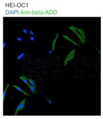 Immunocytochemistry/ Immunofluorescence: beta Adducin Antibody [NBP1-53079]