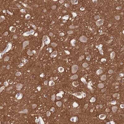 Immunohistochemistry-Paraffin: beta Adducin Antibody [NBP2-33974]