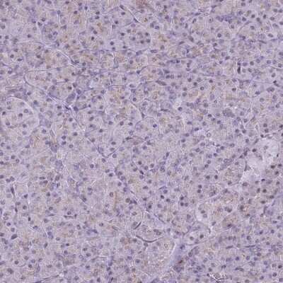 Immunohistochemistry-Paraffin: beta Adducin Antibody [NBP2-33974]