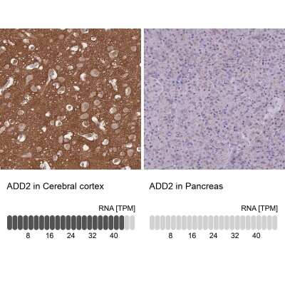 Immunohistochemistry-Paraffin: beta Adducin Antibody [NBP2-33974]
