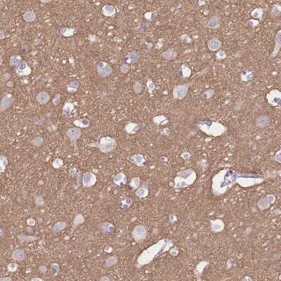 Immunohistochemistry-Paraffin: beta Adducin Antibody [NBP2-33975]