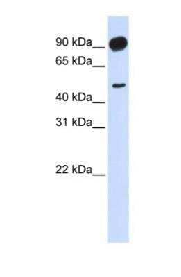 Western Blot: beta Adducin Antibody [NBP1-53079]