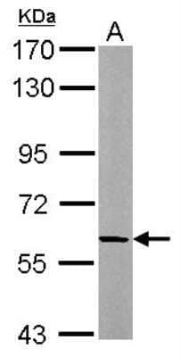 Western Blot: beta Adducin Antibody [NBP2-15573]