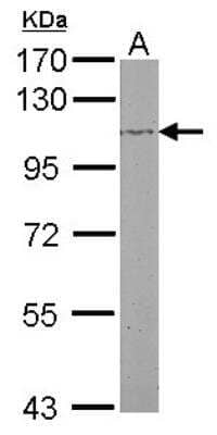 Western Blot: beta Adducin Antibody [NBP2-15574]