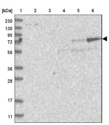 Western Blot: beta Adducin Antibody [NBP2-33974]