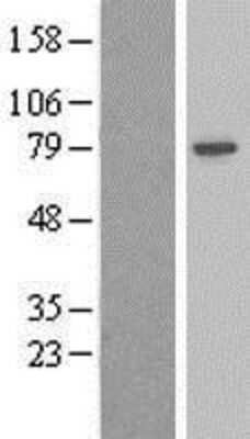 Western Blot: beta Adducin Overexpression Lysate [NBL1-07331]