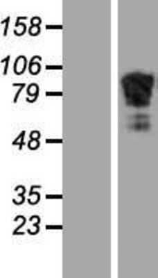 Western Blot: beta Adducin Overexpression Lysate [NBL1-07332]