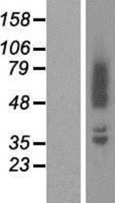 Western Blot: beta Adducin Overexpression Lysate [NBP2-11278]