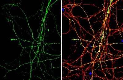 Immunocytochemistry/ Immunofluorescence: beta-Alanine Antibody [NBP3-13408]