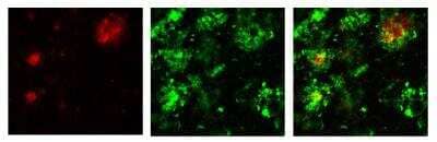 Immunohistochemistry: beta Amyloid [Pyro Glu11] Antibody [NBP1-44070]