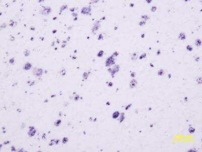 Immunohistochemistry-Paraffin: beta Amyloid 42 Antibody [NBP2-44113]