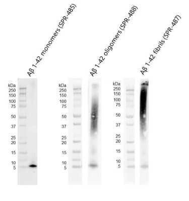 Western Blot: beta Amyloid 42 Peptide [NBP3-18318]