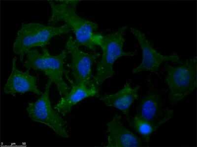 Immunocytochemistry/ Immunofluorescence: beta Amyloid Antibody [NBP1-78007]