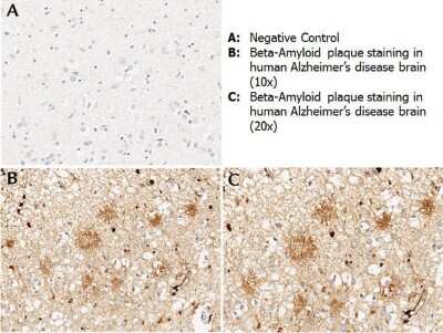 Immunohistochemistry: beta Amyloid Antibody [NBP1-78007]