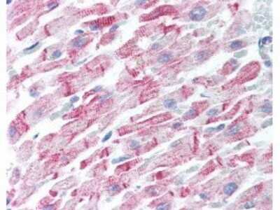 Immunohistochemistry: beta Amyloid Antibody [NBP1-78007]