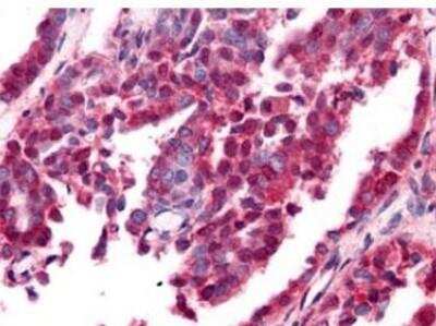 Immunohistochemistry-Paraffin: beta Amyloid Antibody [NBP1-78007]