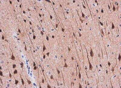 Immunohistochemistry-Paraffin: APP Antibody [NBP2-15575]