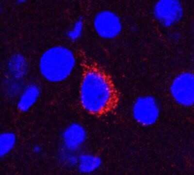 Immunohistochemical Staining of beta Amyloid in Frozen Mouse Brain