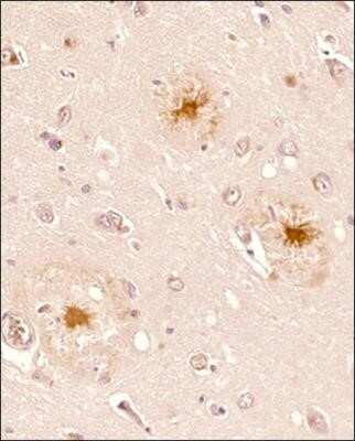 Immunohistochemical Staining of beta Amyloid in Paraffin Embedded Human Brain