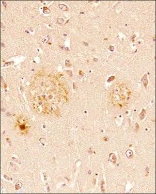 Immunohistochemical Analysis of beta Amyloid in Paraffin Embedded Human Brain