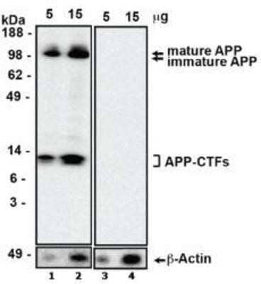 Western Blot Analysis of HEK-APP SWE/BACE1 Cell Lysates Using beta Amyloid Antibody