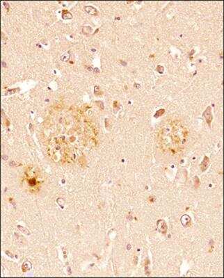 Immunohistochemical Analysis of beta Amyloid in Paraffin Embedded Human Brain