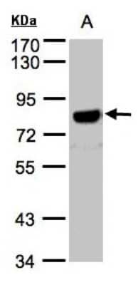 Western Blot: APP Antibody [NBP1-32081]