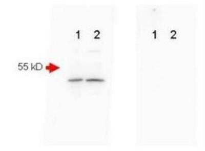 Western Blot: beta Amyloid Antibody [NBP1-78007]