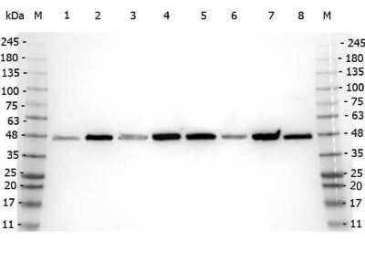Western Blot: beta Amyloid Antibody [NBP1-78007]
