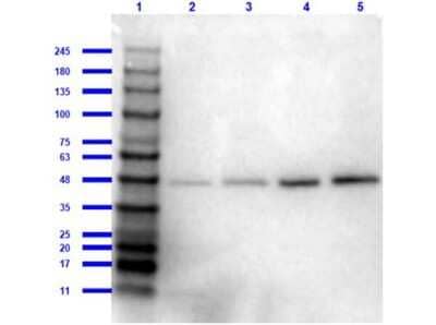 Western Blot: beta Amyloid Antibody [NBP1-78007]