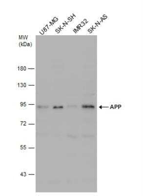 Western Blot: APP Antibody [NBP2-15575]