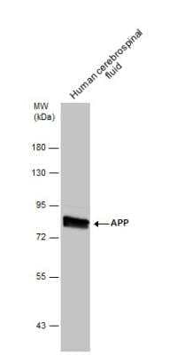 Western Blot: APP Antibody [NBP2-15575]