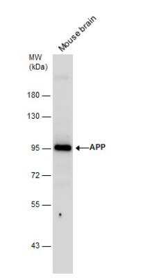 Western Blot: APP Antibody [NBP2-15575]
