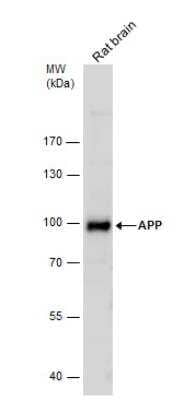 Western Blot: APP Antibody [NBP2-15575]