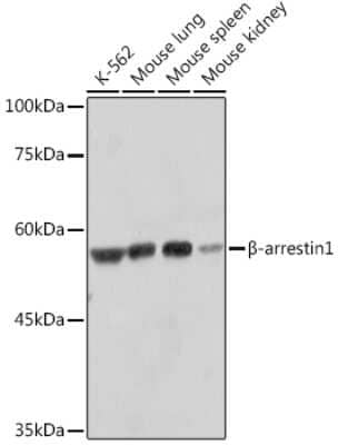 Western Blot: beta-Arrestin 1 Antibody (F7C2) [NBP3-15335]