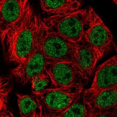 Immunocytochemistry/ Immunofluorescence: beta-Arrestin 1 Antibody [NBP2-58092]